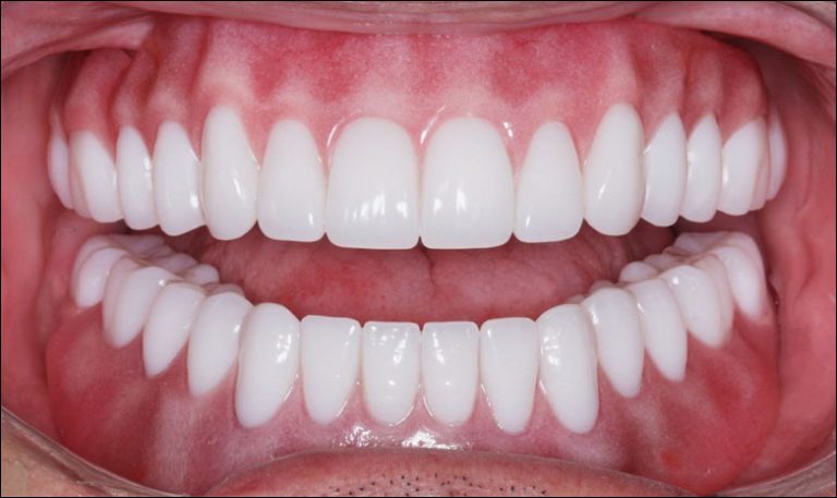 Dundalk Denture Laboratory