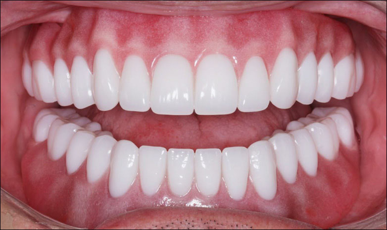 Dundalk Denture Laboratory