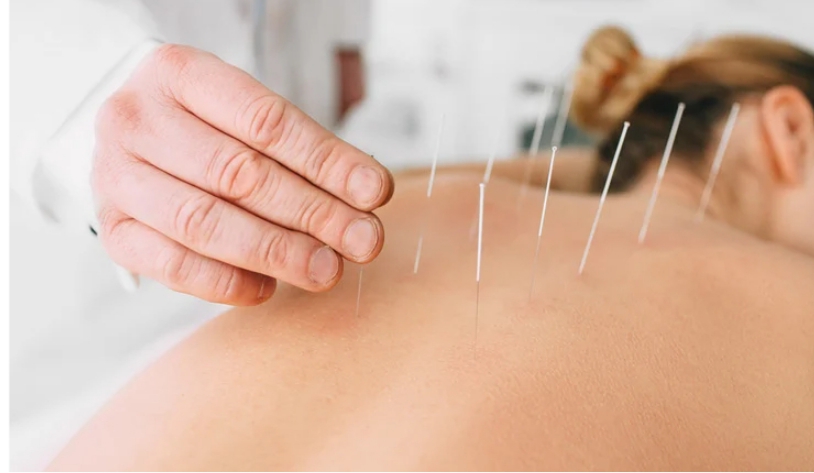 Acusana Acupuncture Clinic
