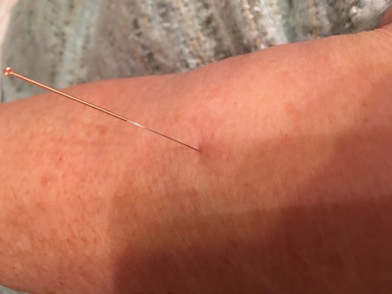 Cavan Acupuncture Clinic