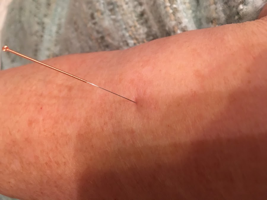 Cavan Acupuncture Clinic