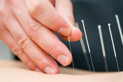 Herbs & Acupuncture