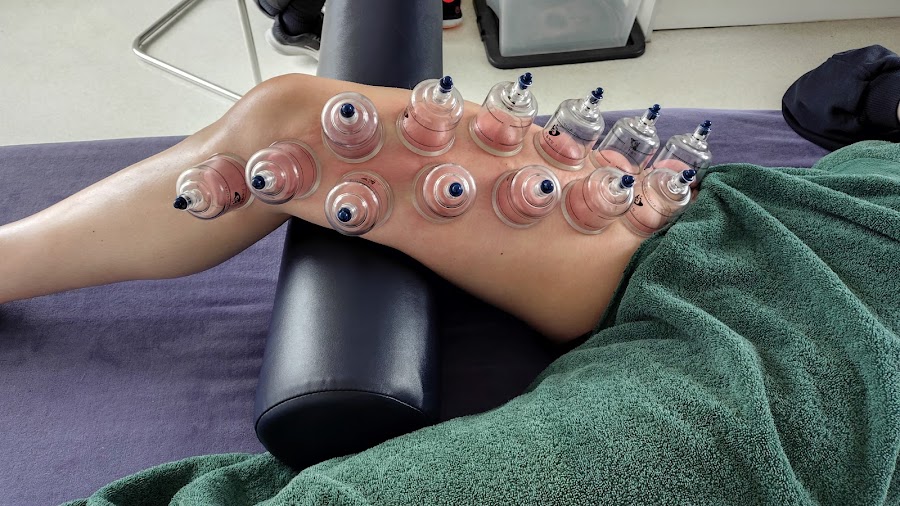 McGrath Neuromuscular Therapy Belcoo & Enniskillen