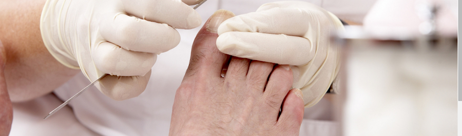 The Chiropody Surgery