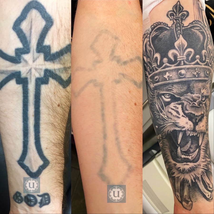 UberSkin