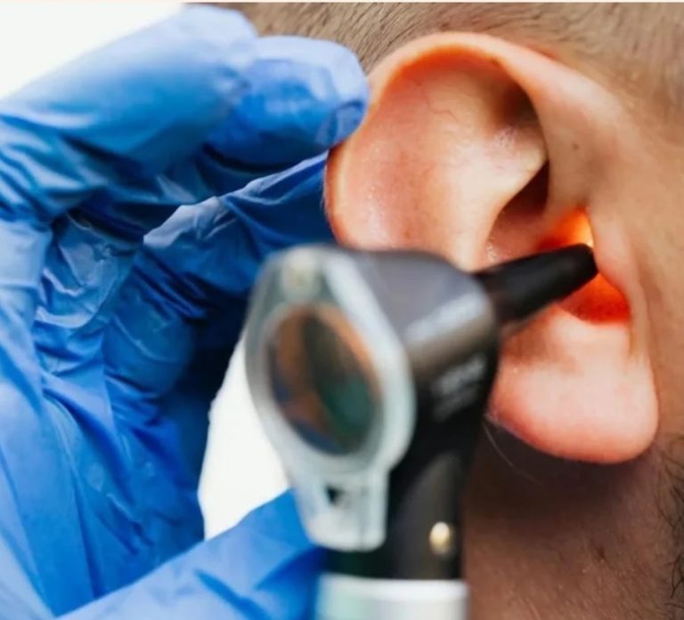 Ask the Audiologist